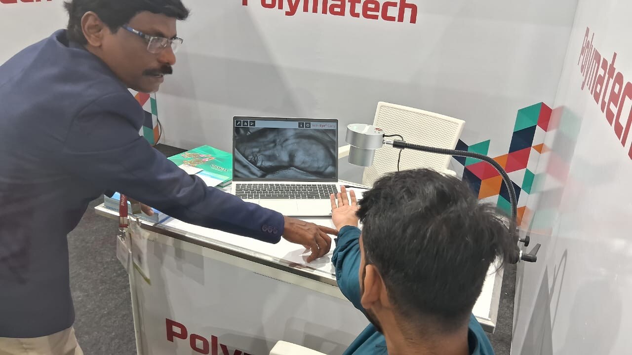 Live demonstration of the Polymatech Vein Finder